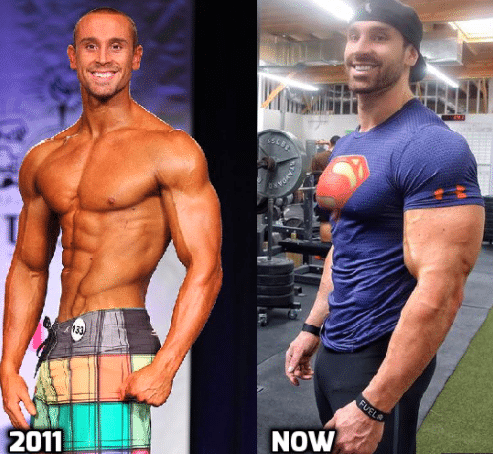 Is Bradley Martyn On Steroids Or is He Natural?