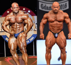What Is Palumboism (HGH Guts)? Causes And Case Study